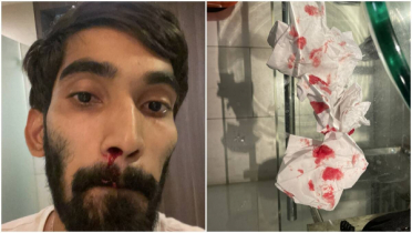 ইরাকে নাক দিয়ে রক্ত ​​পড়া প্রাণঘাতী জ্বরে ১৯ জনের মৃত্যু