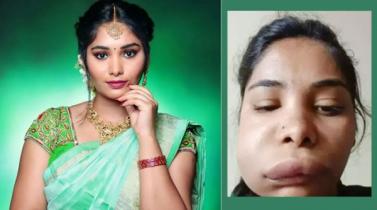 তরুণ অভিনেত্রীর করুণ অবস্থা