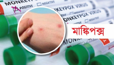 মাঙ্কিপক্সে প্রথম মৃত্যু দেখলো স্পেন ও ব্রাজিল