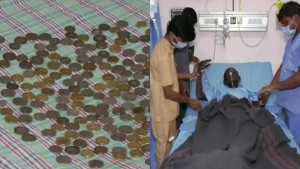 পেটের ভেতর থেকে বেরোল ১৮৭টি কয়েন!