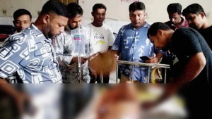 ছাত্রদল নেতার গায়ে গরম পানি ঢেলে দিলেন আ.লীগ কর্মী