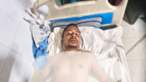 গুইমারায় কাঠ ব্যবসায়ীকে পিটিয়ে আহত করার অভিযোগ