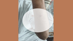 রিপোর্ট দেখাতে গিয়ে স্বজনকে পেটানোর অভিযোগ চিকিৎসকের বিরুদ্ধে