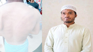 চকরিয়ায় ২০ টাকা চুরির অভিযোগে শিশুকে মারধর, শিক্ষক গ্রেপ্তার