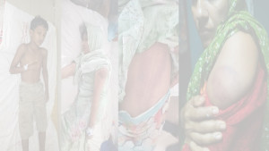 টাকা চুরির অপবাদে শিশুকে শিকলে বেঁধে নির্যাতন, মাকেও মারধরের অভিযোগ